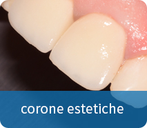 corone estetiche zirconia ceramica
