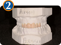 mock-up delle faccette