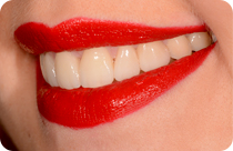 il nuovo sorriso di alessia