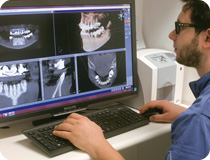 analisi risultato esame 3D tac cone beam
