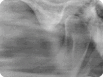 analisi risultato esame 3D tac cone beam