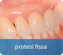 protesi fissa